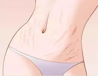 鸡西爱玛家月子中心产后修复,鸡西爱玛家月子中心满月篇