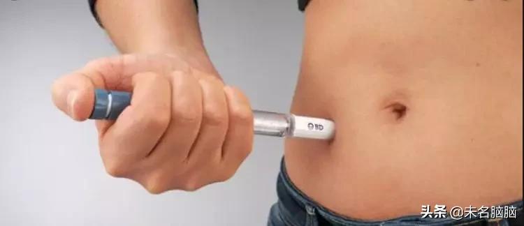 哪些是阿尔茨海默症的风险因素,老年性痴呆阿尔茨海默病病例