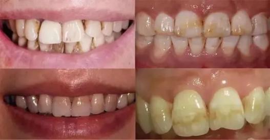 濂冲+鍙h厰棣欐按鎸佷箙鐣欓,濂介椈鍙h厰鍠烽浘棣欐按