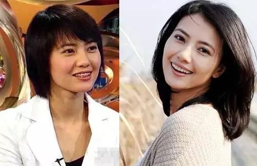 哪些明星整牙后像整容,明星整牙变美了