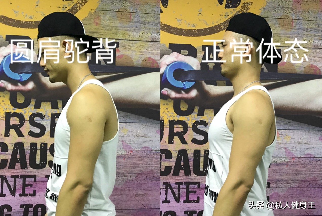 如何矫正驼背的正确方法,驼背怎么办五个动作帮你改正驼背