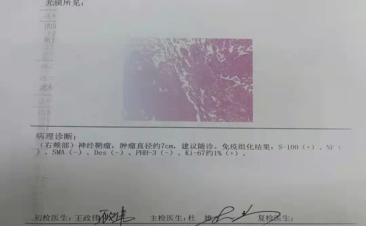 寤跺ぇ闄勫睘鍖婚櫌鑲跨槫,棰岄潰娣遍儴鑲跨槫鎬庝箞娌荤枟