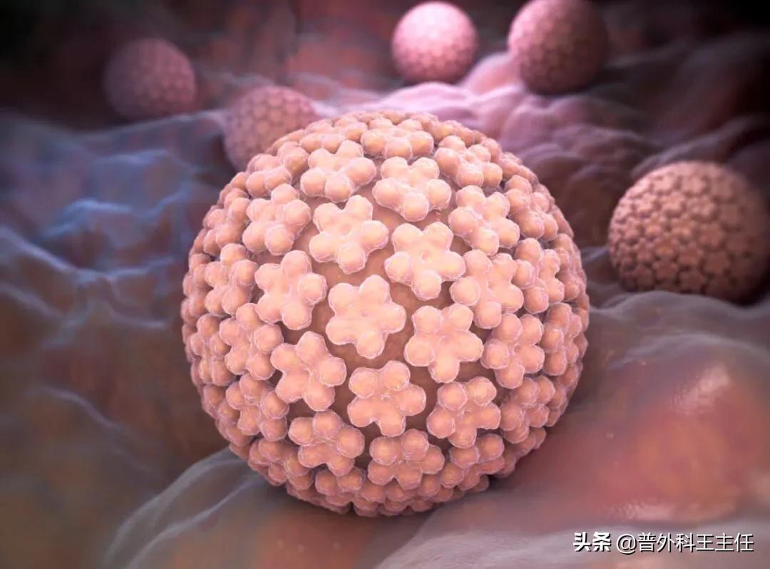 尖锐性湿疣用药还是手术,尖锐性湿疣用激光治疗还是吃药