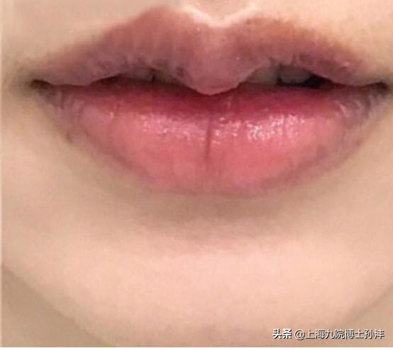 涔濋櫌瀛欐玻,瀛欐玻鍗氬＋妗堜緥