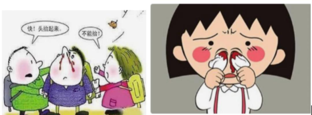 儿童白血病鼻出血症状,儿童左鼻出血警惕四种原因