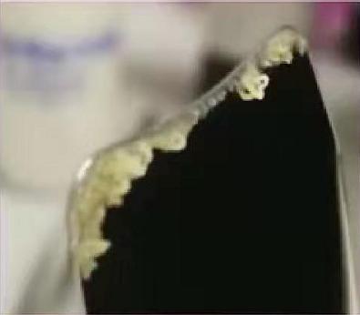 黑头多怎么办干货,黑头挤完了怎么处理才不会留痘坑