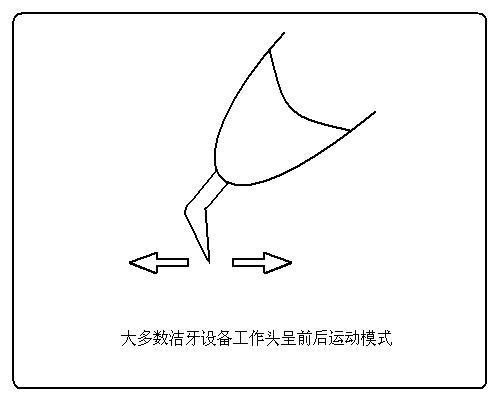 超声波洗牙和声波洗牙有什么区别,超声波洗牙跟超声波喷砂洗牙区别