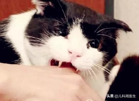 被小猫挠伤需要打疫苗吗,被猫挠了出血了需要打疫苗吗