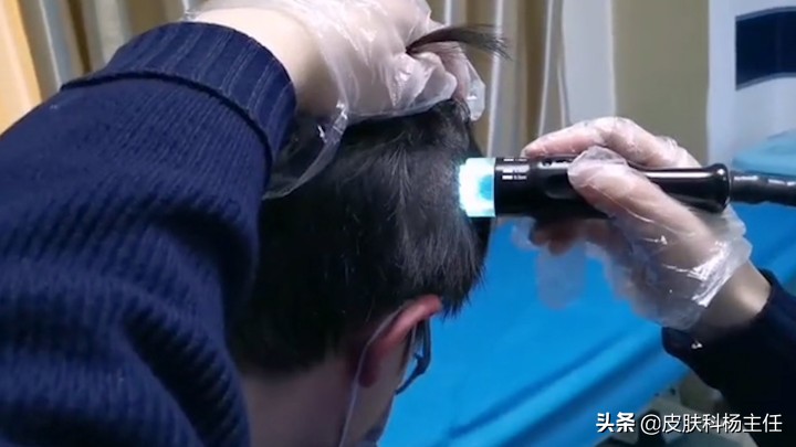 「专家揭秘」为什么照射紫外线对银屑病有治疗作用？