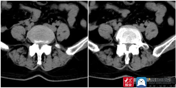 鑴婃煴寰垱鎵嬫湳璁惧,鑴婃煴鎵嬫湳鍏堣繘璁惧