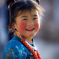 孩子脸冻成高原红怎么办,小婴儿高原红