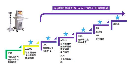 妇科tct报告如何解读,tct几天能拿报告