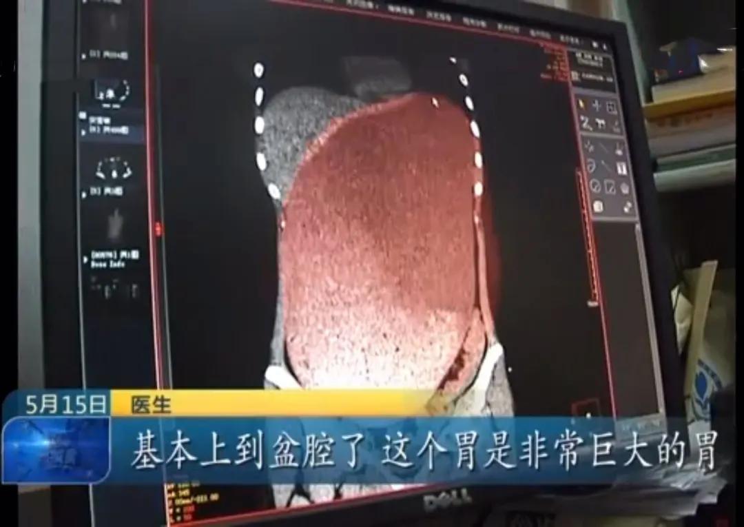 节食还想提高代谢怎么办,节食又运动