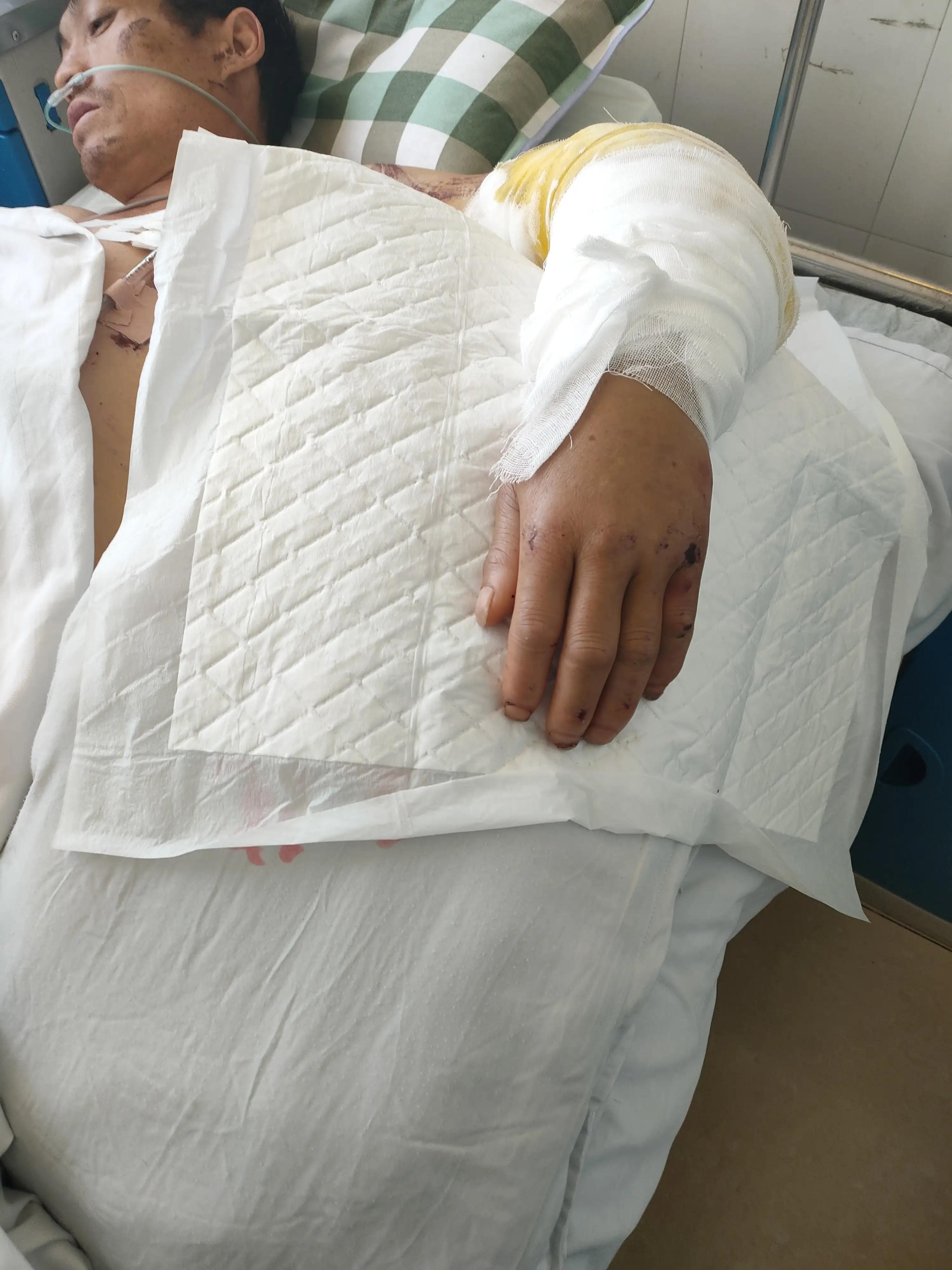 父亲出车祸,父亲出了车祸去世了该怎么处理