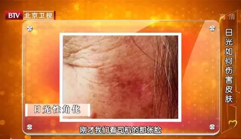 女人过了25岁怎么保养皮肤,30岁女性如何保养身体维持健康