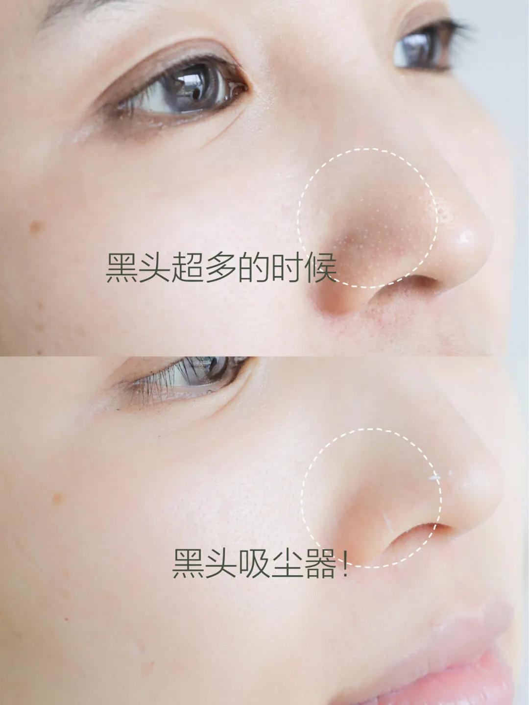 科颜氏的白膜,科颜氏面膜顺序