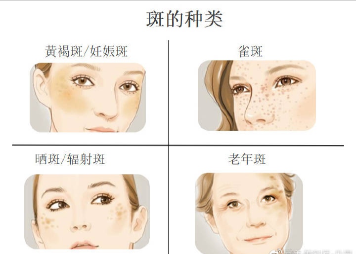 长斑了如何淡斑有效,肌肤长疙瘩怎么治