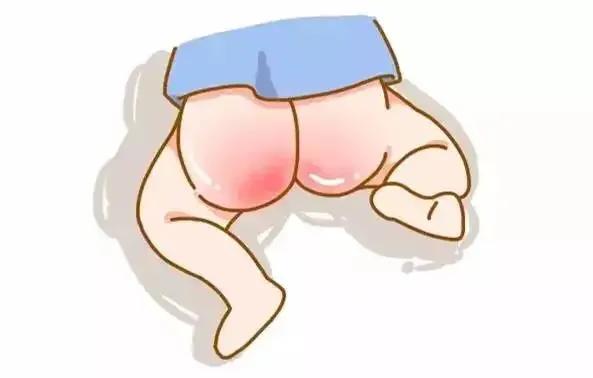 宝宝红屁股怎样护理,宝宝红屁股怎么护理最好