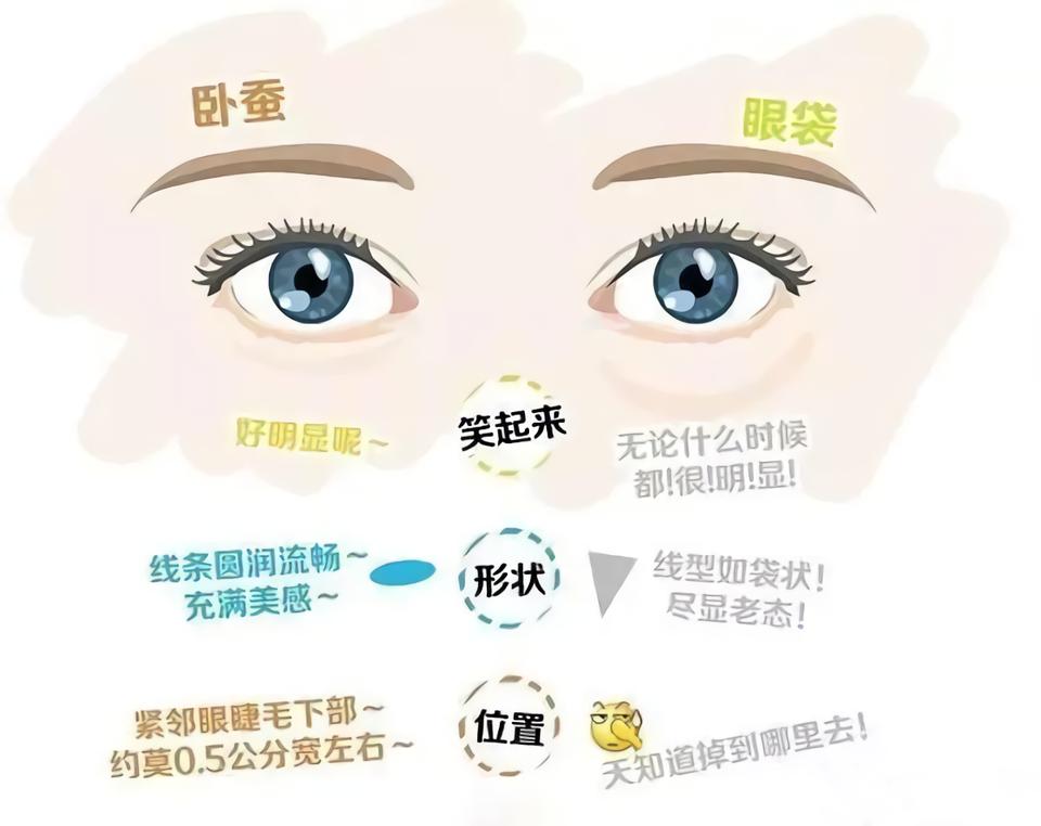 有眼袋是不是真的显老,有眼袋人显老快试试这个方法吧