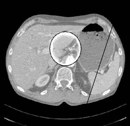 ct图像解析大全,ct图像与实物大小对比