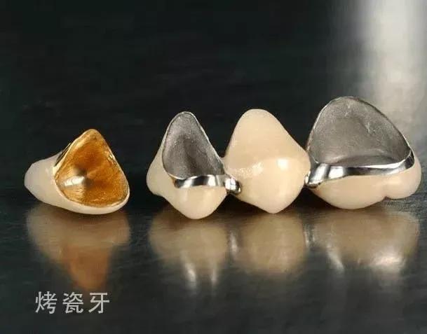 明星的牙都是真牙吗,如何辨别优秀的牙医