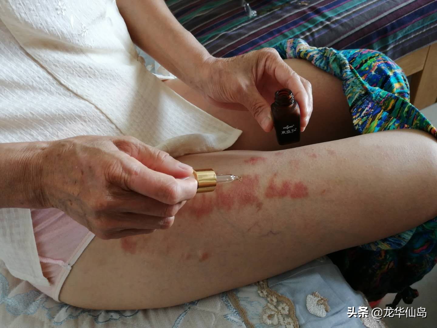 蟒蛇油使用案例与方法