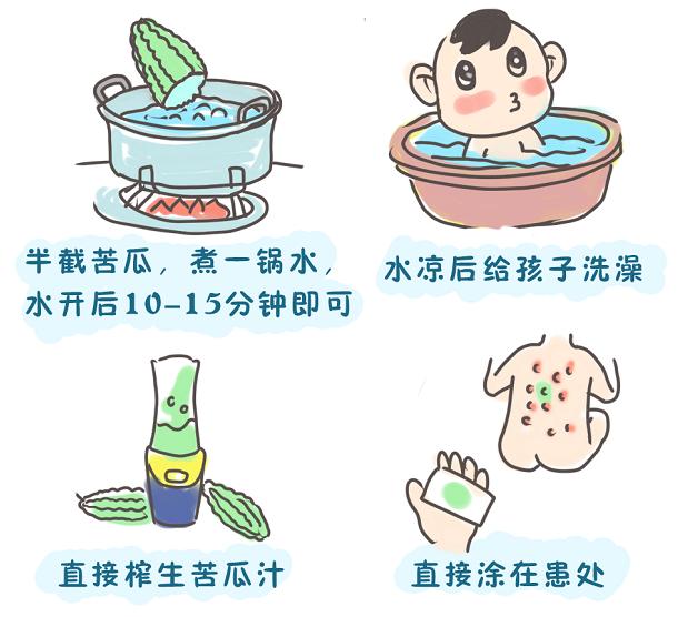 夏天热疹怎么防止,夏季出汗引起的皮肤病怎么办