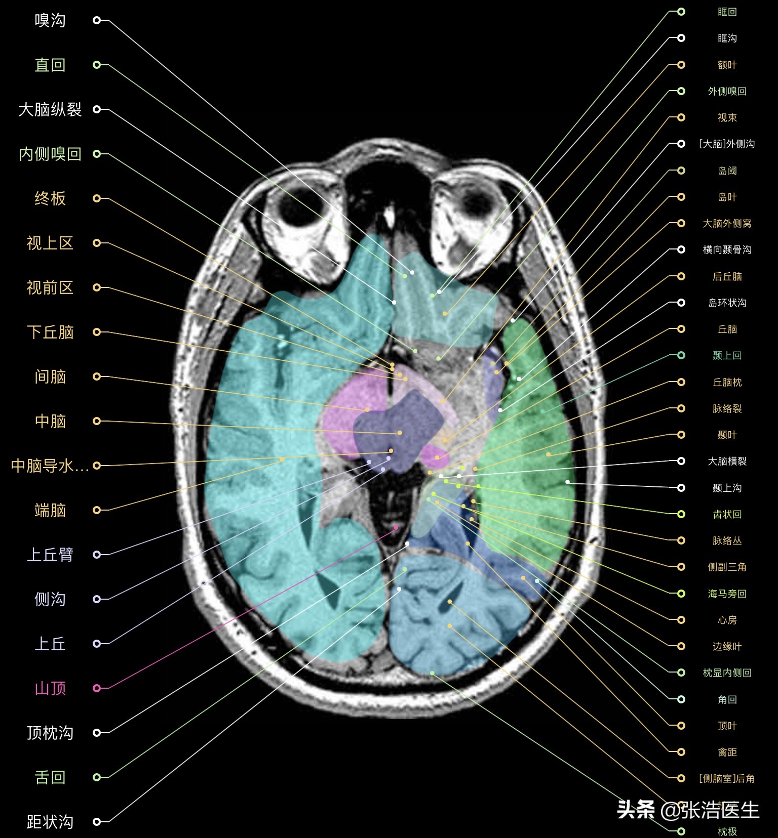 颅脑mri断层解剖视频课件,颅脑mri解剖手绘图