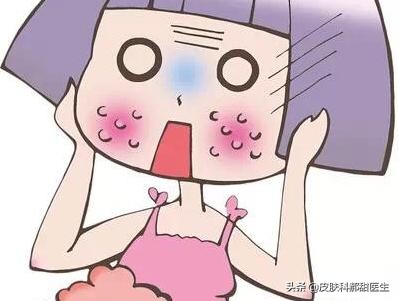 脸部皮肤过敏期间怎么护肤,脸部过敏是护肤品还是食物导致的