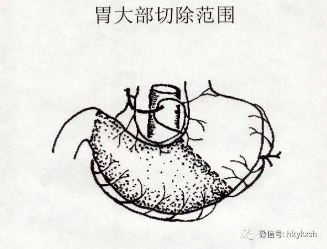 科普消化与健康,科普消化系统