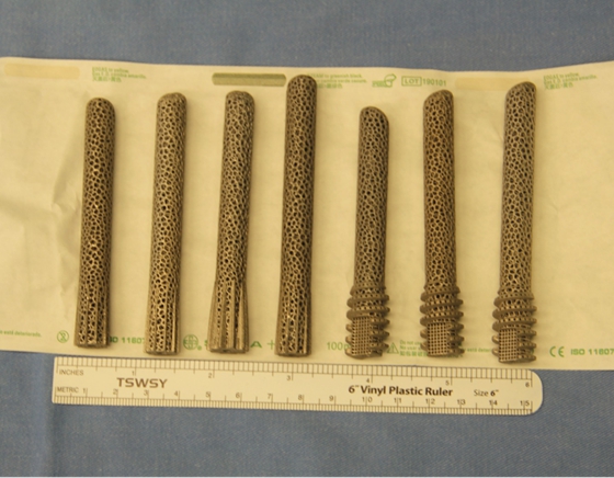 3d打印人工股骨头关节最新技术,3d打印人工骨再造脚趾