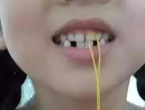 小朋友牙齿受到外伤如何正确处理,牙齿意外脱落如何处理