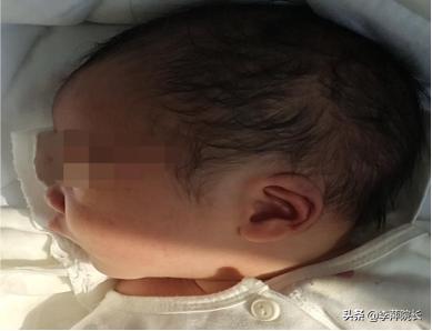 菏泽姑娘2年不孕,当地医院查出囊肿,老主任竟说囊肿不用治疗