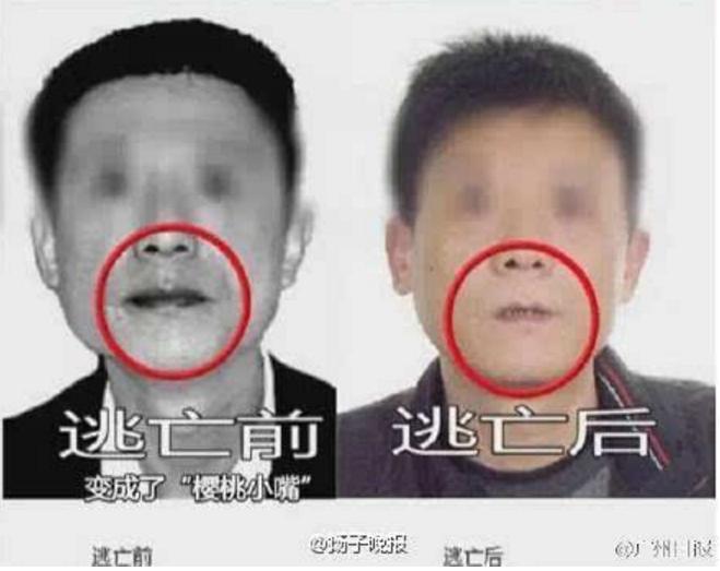 槟榔成口腔癌高发的主要诱因,槟榔是如何导致口腔癌的呢