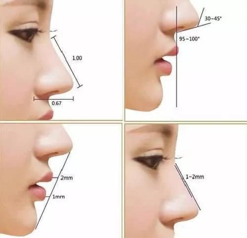 比较自然的隆鼻方式有哪些,哪种隆鼻方式最不容易歪