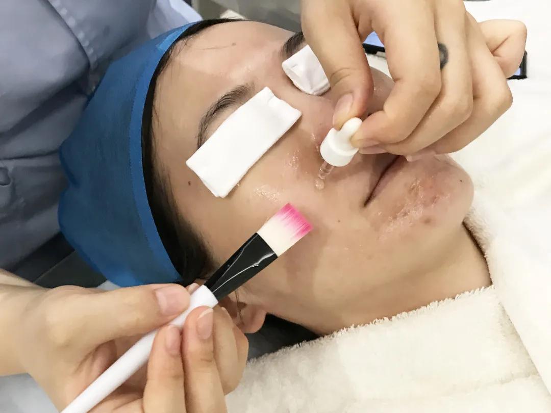 黑头毛孔粗大到底怎么治,黑头毛孔粗大有没有必要去改善