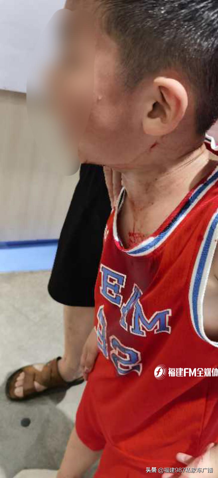 孩子在游乐场磕破下巴索赔多少,孩子在儿童乐园磕碰家长讹人