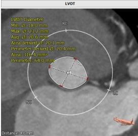 罗建方医生怎么样,罗建方教授