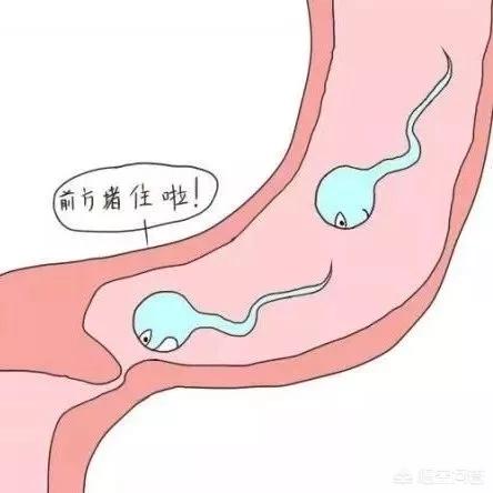 输卵管积水是什么症状,输卵管积水有什么症状