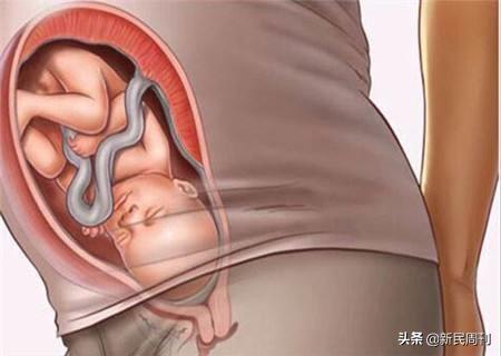 赵爱民保胎一定要两周复诊一次吗,赵爱民保胎到几周