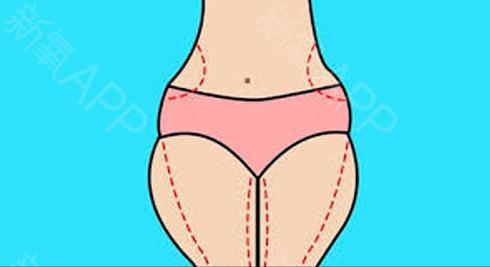 抽脂感染去世的网红,网红抽脂感染离世抖音