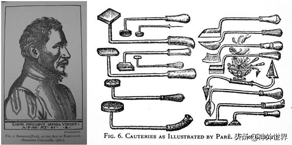 神经外科的止血方法,神经外科医学常识总结
