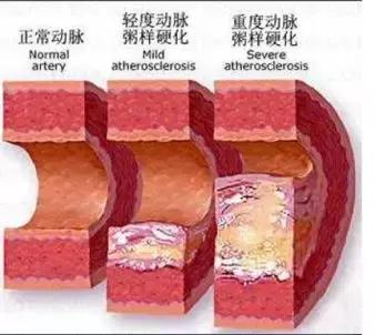 科普如何正确认识耳鸣,科普文的趣味性