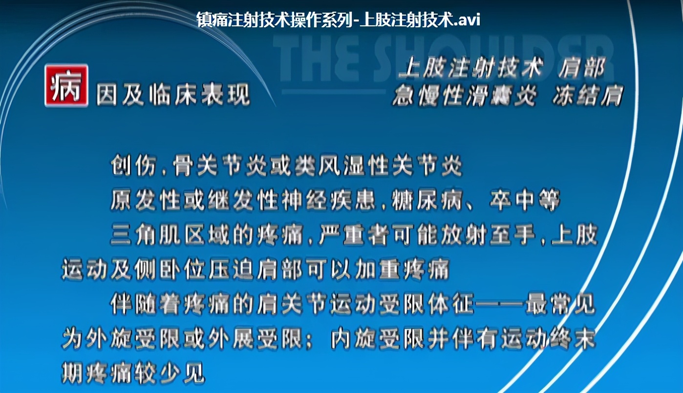 镇痛注射教学视频,疼痛科注射药物及方法