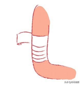 专家级指导:外伤后如何包扎伤口