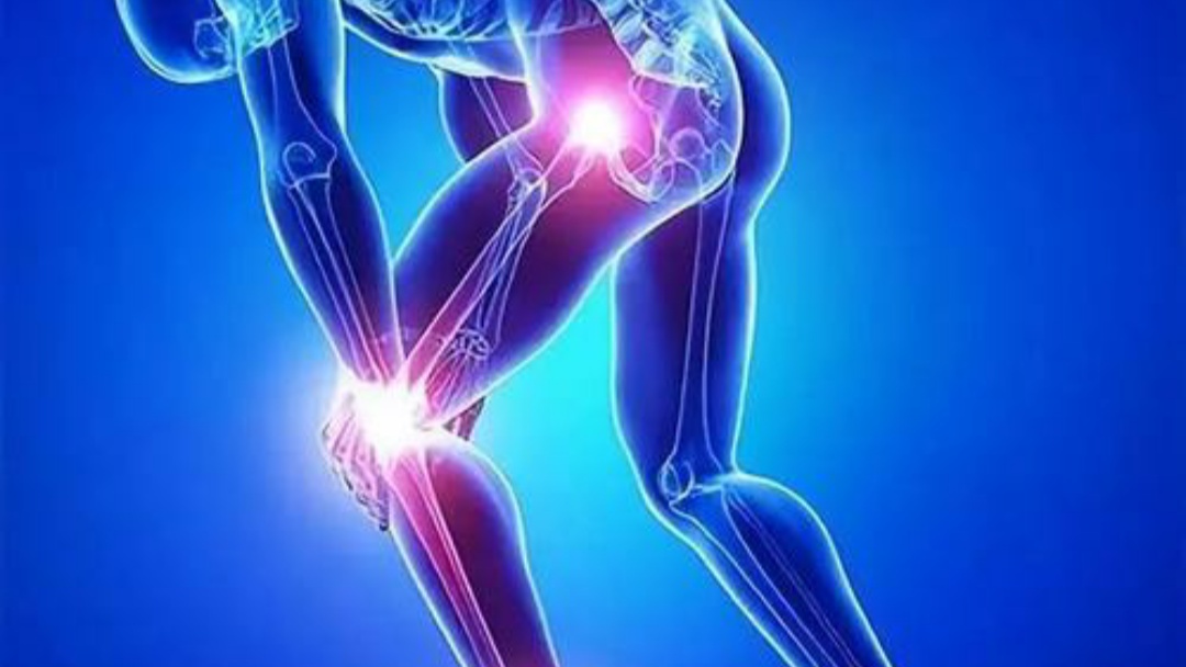 粘多糖储积症是隐性遗传病,一共有7种类型,多由基因变异导致