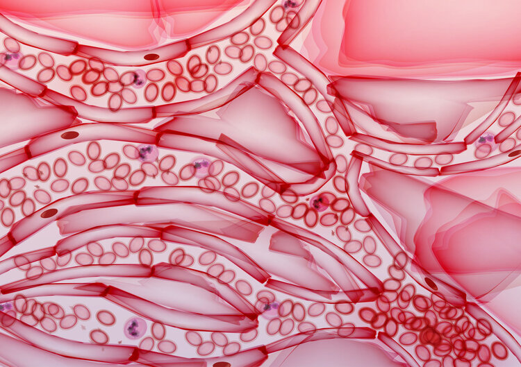 严重崴脚不治的后果,崴脚20天不消肿是骨头裂了吗