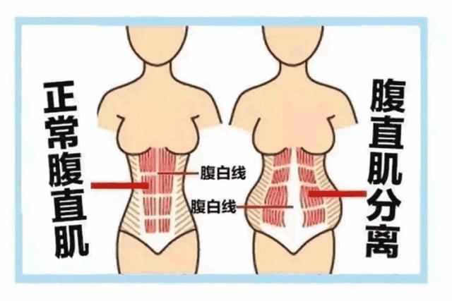 出月子瘦到孕前,出月子瘦了10斤