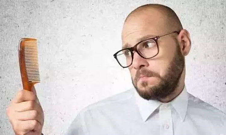 90后脱发护发,90后脱发怎么长回来