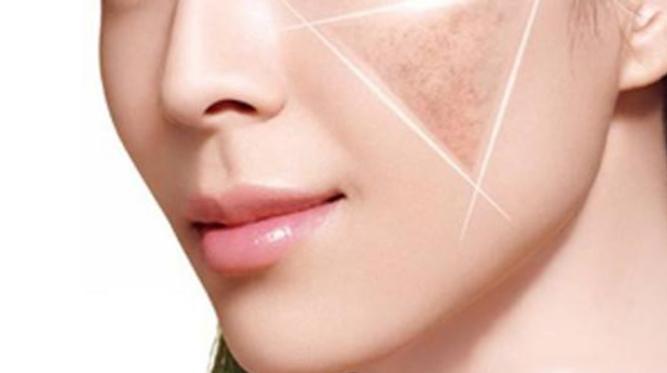 脸上有斑怎么调理淡化色斑吃什么,脸上有斑抹什么维e可以淡化色斑